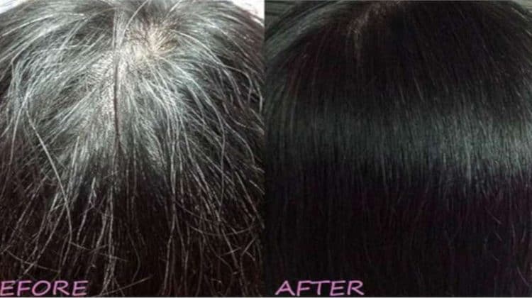 सफ़ेद बाल काले करने के उपाय / White Hair Remedies